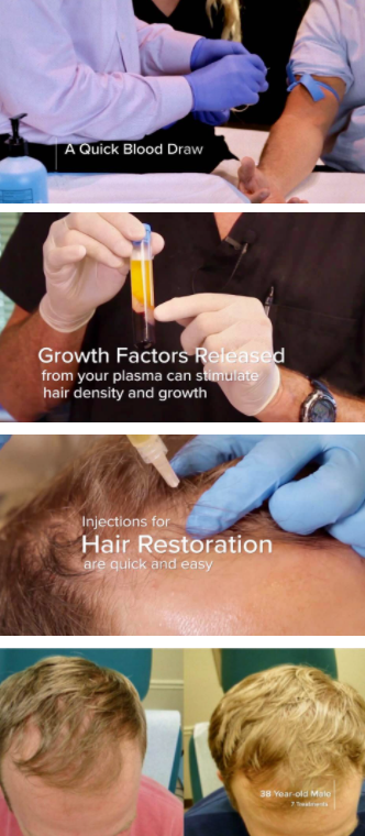 Hair Restoration