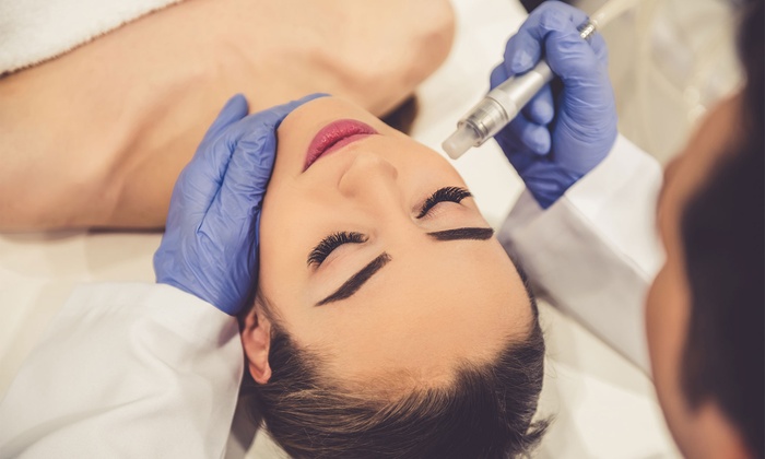 Microdermabrasion