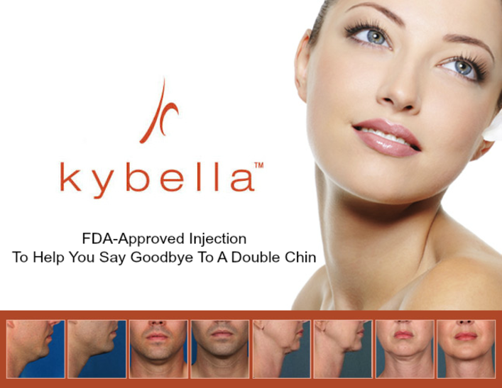Kybella
